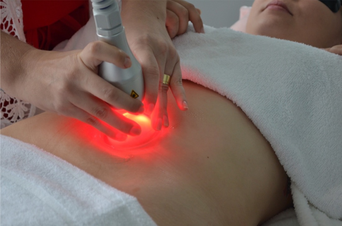Vácuo Laser (Endermologia) — Clínica Carina Borges